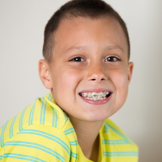 Young boy smiling with braces for Phase 1 pediatric orthodontics in Wayland
