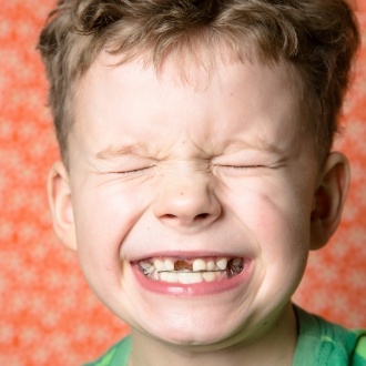 Young boy grinning with a few missing and crooked teeth